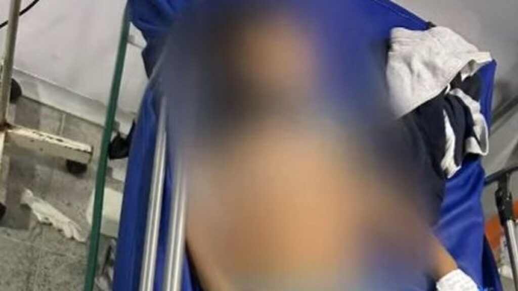 Criança de 6 anos é baleada durante ataque a tiros no Jacintinho, em Maceió