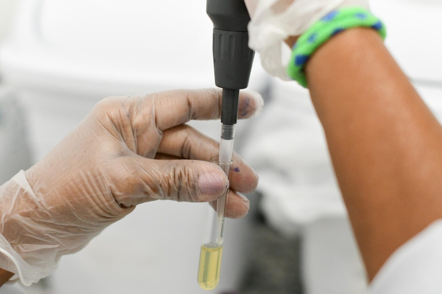 Quase 300 hemofílicos têm acesso a assistência integral do Hemocentro de Alagoas